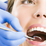 Comprehensive Guide to Dental Fillings: Diagnosis, Treatment, Symptoms, Causes, and More